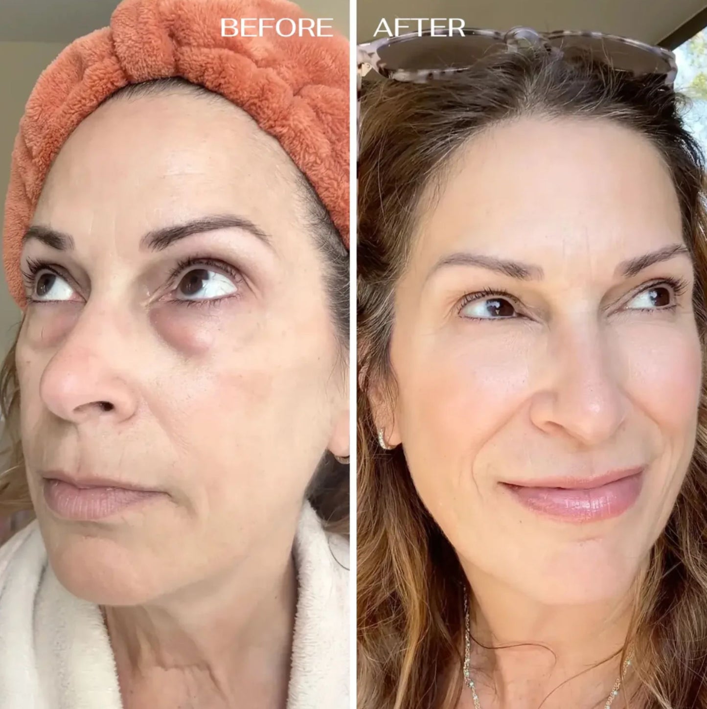 Cemenrete Calcium Balm By Eleyan